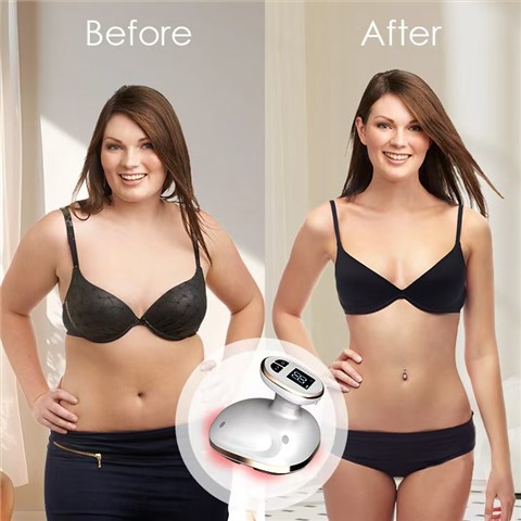 New Beauty Anti Cellulite Belly Waist Leg Arm Fat Remover