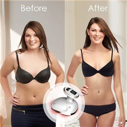 Body Shaping Machine Stretch Mark Massager Tightening Device